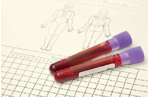 CYP2C19ˎxøB(ti)ԙzyԇעԼg(sh)ָ(do)ԭt